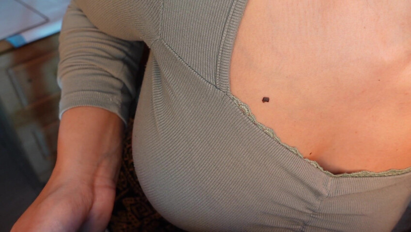 Irma La Dulce - Chiropractic Sex Therapist - Releasing Trapped Gum